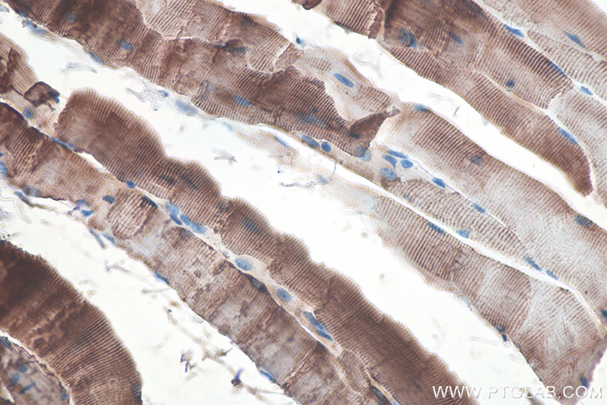 Immunohistochemical analysis of paraffin-embedded mouse skeletal muscle tissue slide using KHC0100 (Desmin IHC Kit).