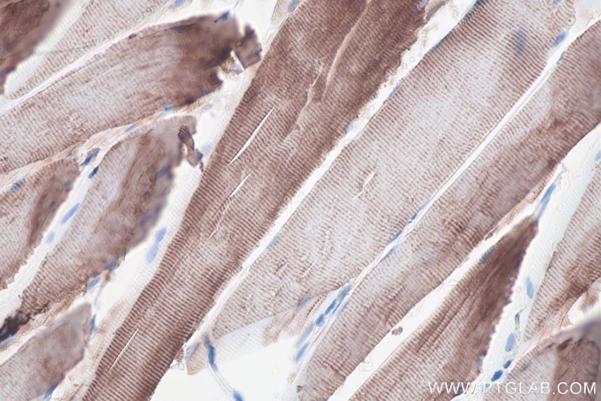 Immunohistochemical analysis of paraffin-embedded rat skeletal muscle tissue slide using KHC0100 (Desmin IHC Kit).