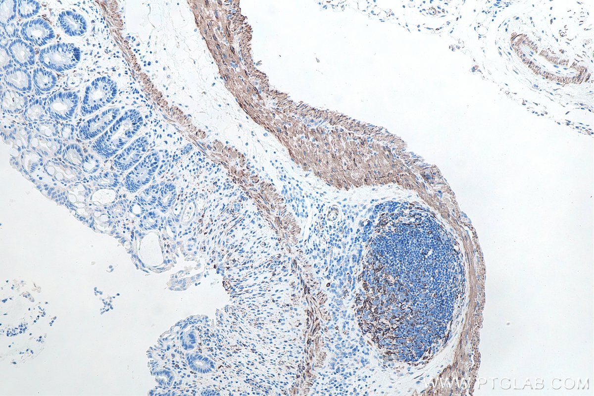 Immunohistochemical analysis of paraffin-embedded mouse colon tissue slide using KHC0100 (Desmin IHC Kit).