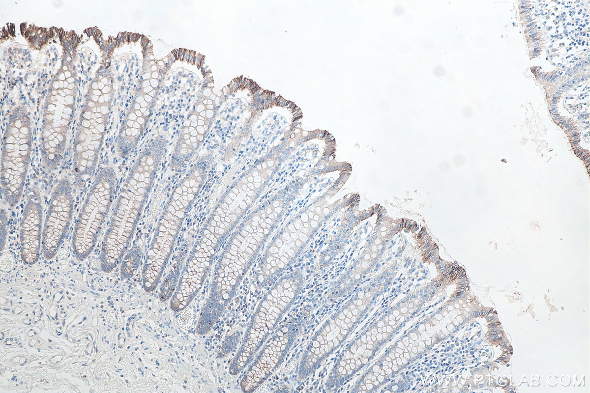 Immunohistochemical analysis of paraffin-embedded human colon tissue slide using KHC0091 (Desmocollin 2 IHC Kit).