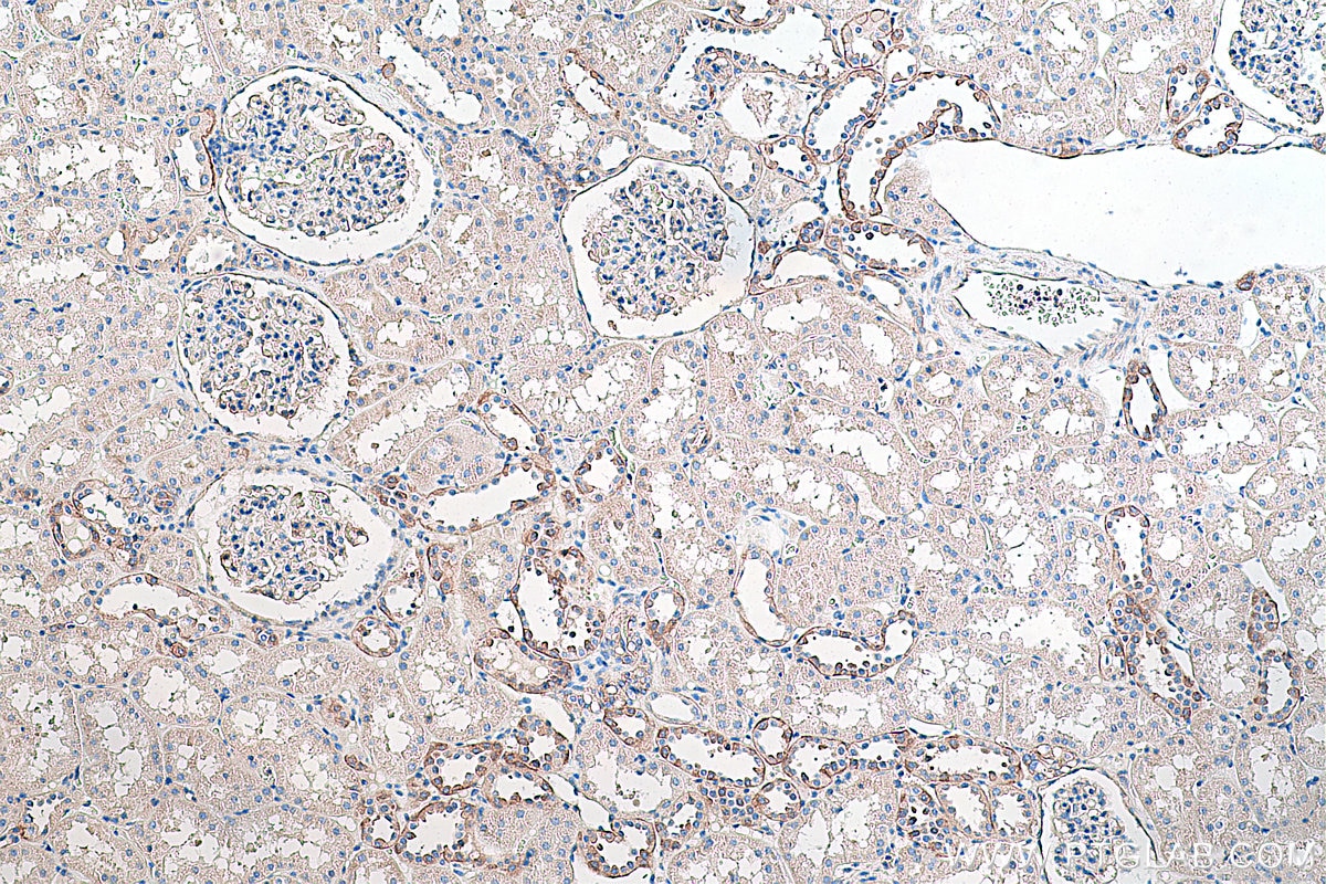 Immunohistochemical analysis of paraffin-embedded human kidney tissue slide using KHC0284 (Dystrophin/DMD IHC Kit).