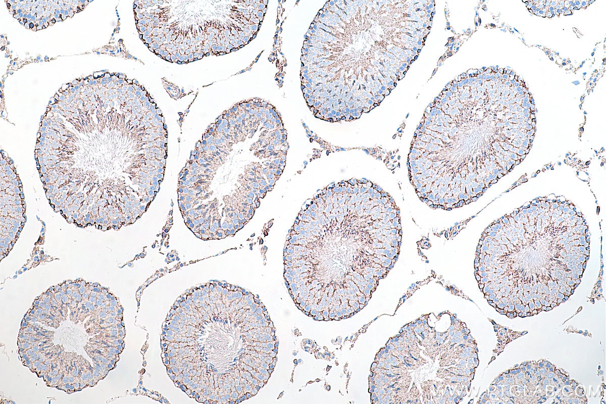 Immunohistochemical analysis of paraffin-embedded rat testis tissue slide using KHC0284 (Dystrophin/DMD IHC Kit).