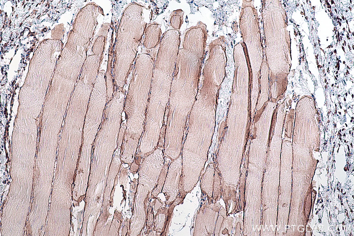 Immunohistochemical analysis of paraffin-embedded rat skeletal muscle tissue slide using KHC0284 (Dystrophin/DMD IHC Kit).