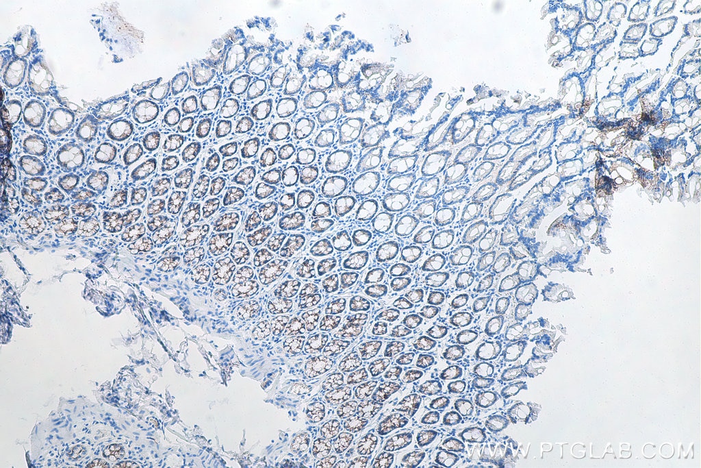 Immunohistochemical analysis of paraffin-embedded rat colon tissue slide using KHC0010 (E-cadherin IHC Kit)