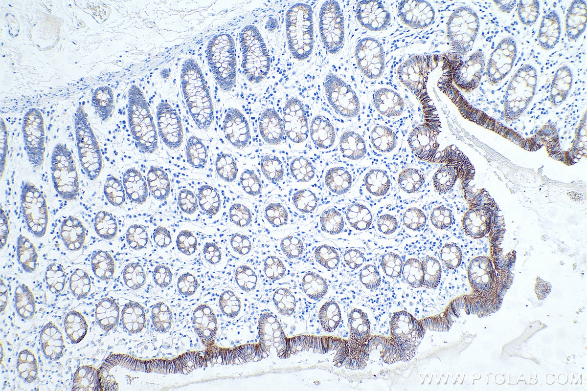 Immunohistochemical analysis of paraffin-embedded human colon tissue slide using KHC0010 (E-cadherin IHC Kit).