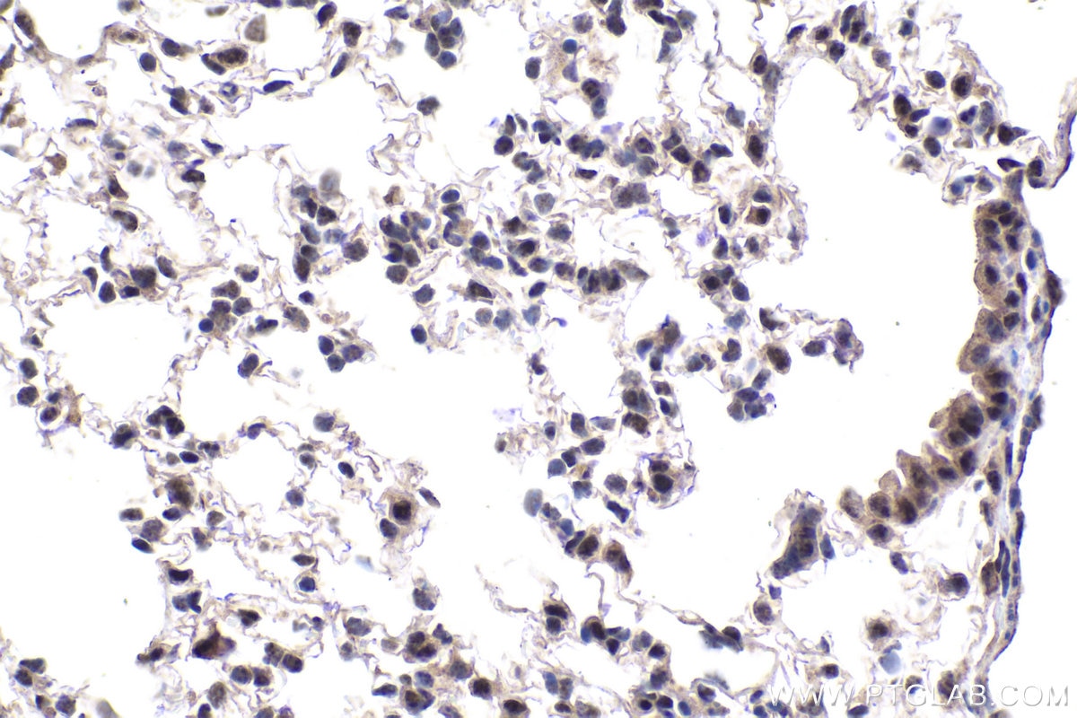 Immunohistochemical analysis of paraffin-embedded mouse lung tissue slide using KHC1877 (EAF1 IHC Kit).