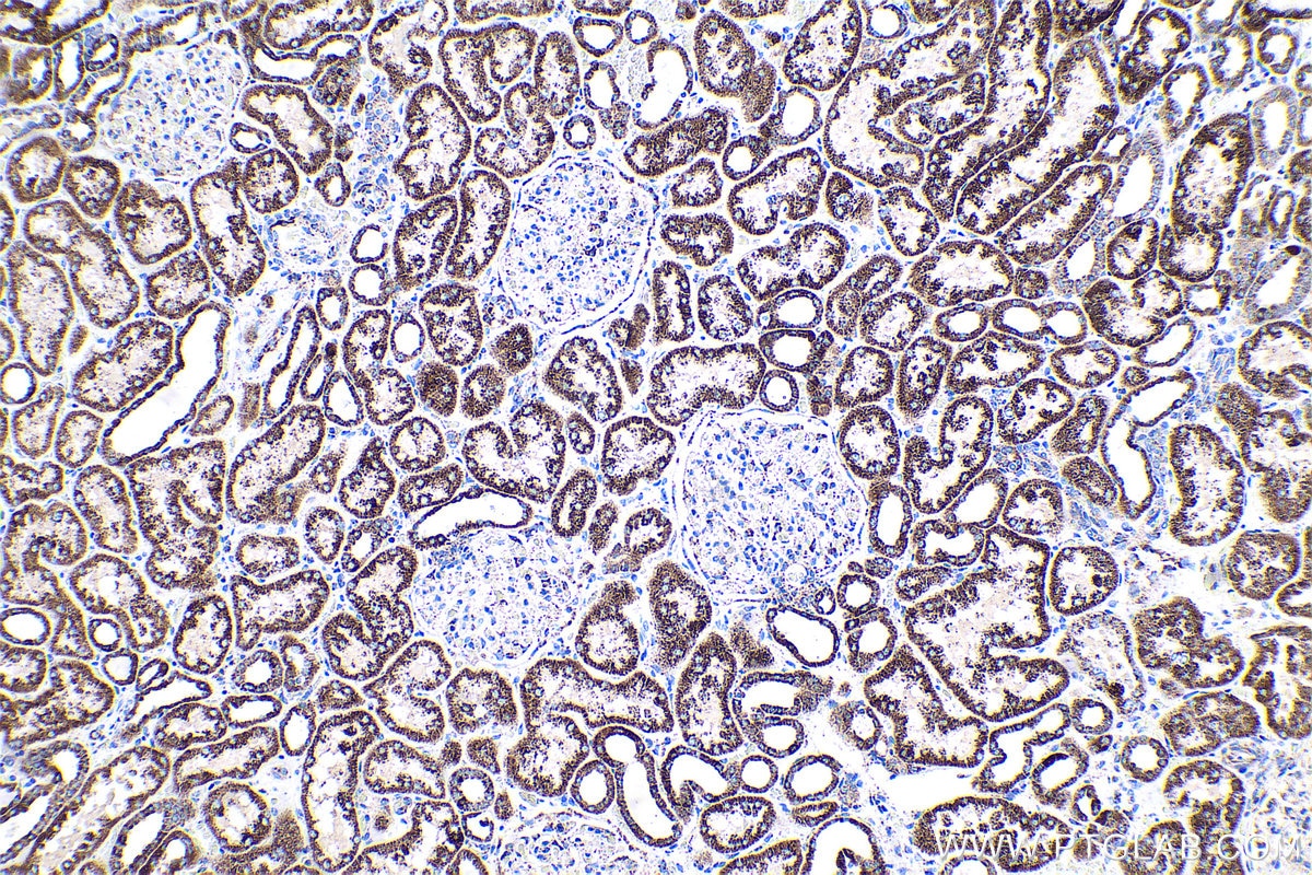 Immunohistochemical analysis of paraffin-embedded human kidney tissue slide using KHC0589 (ECH1 IHC Kit).