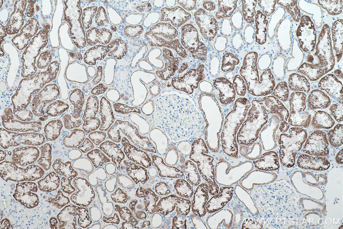 Immunohistochemical analysis of paraffin-embedded human kidney tissue slide using KHC0514 (ECHS1 IHC Kit).