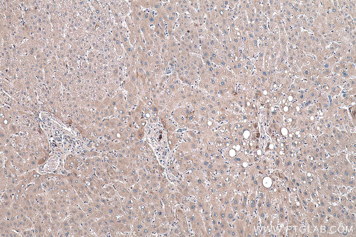 Immunohistochemical analysis of paraffin-embedded human liver tissue slide using KHC0481 (ECM1 IHC Kit).