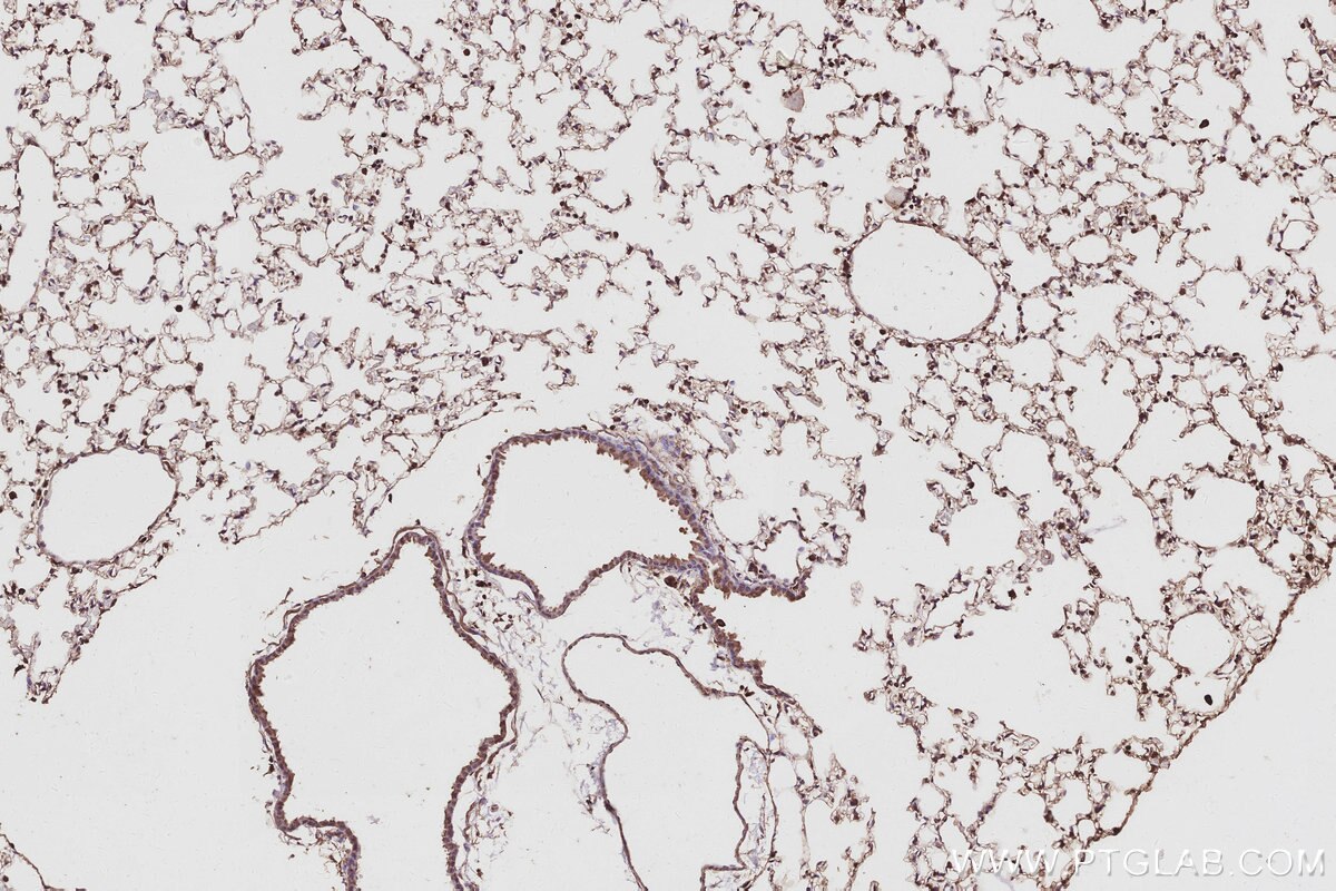 Immunohistochemical analysis of paraffin-embedded mouse lung tissue slide using KHC2964 (ECT2 IHC Kit).