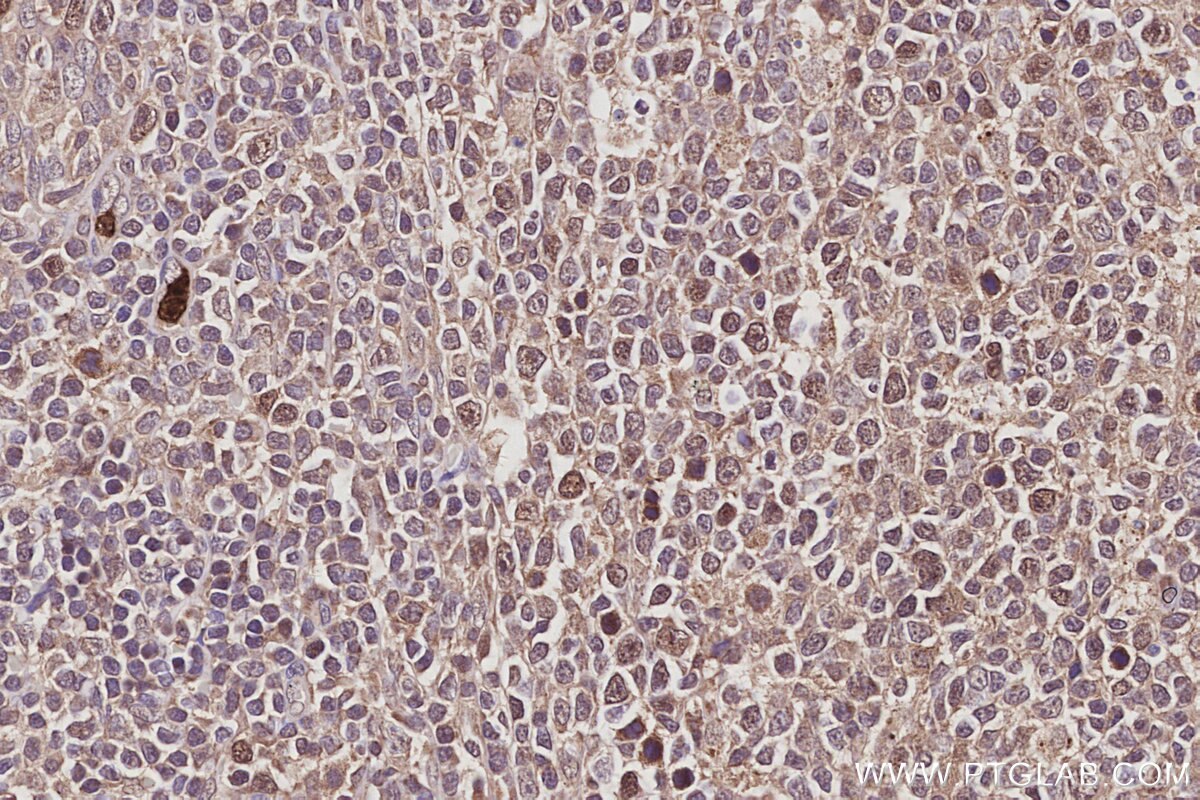 Immunohistochemical analysis of paraffin-embedded human tonsillitis tissue slide using KHC2964 (ECT2 IHC Kit).