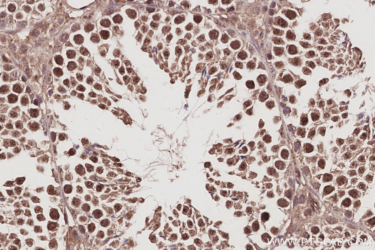Immunohistochemical analysis of paraffin-embedded mouse testis tissue slide using KHC2964 (ECT2 IHC Kit).