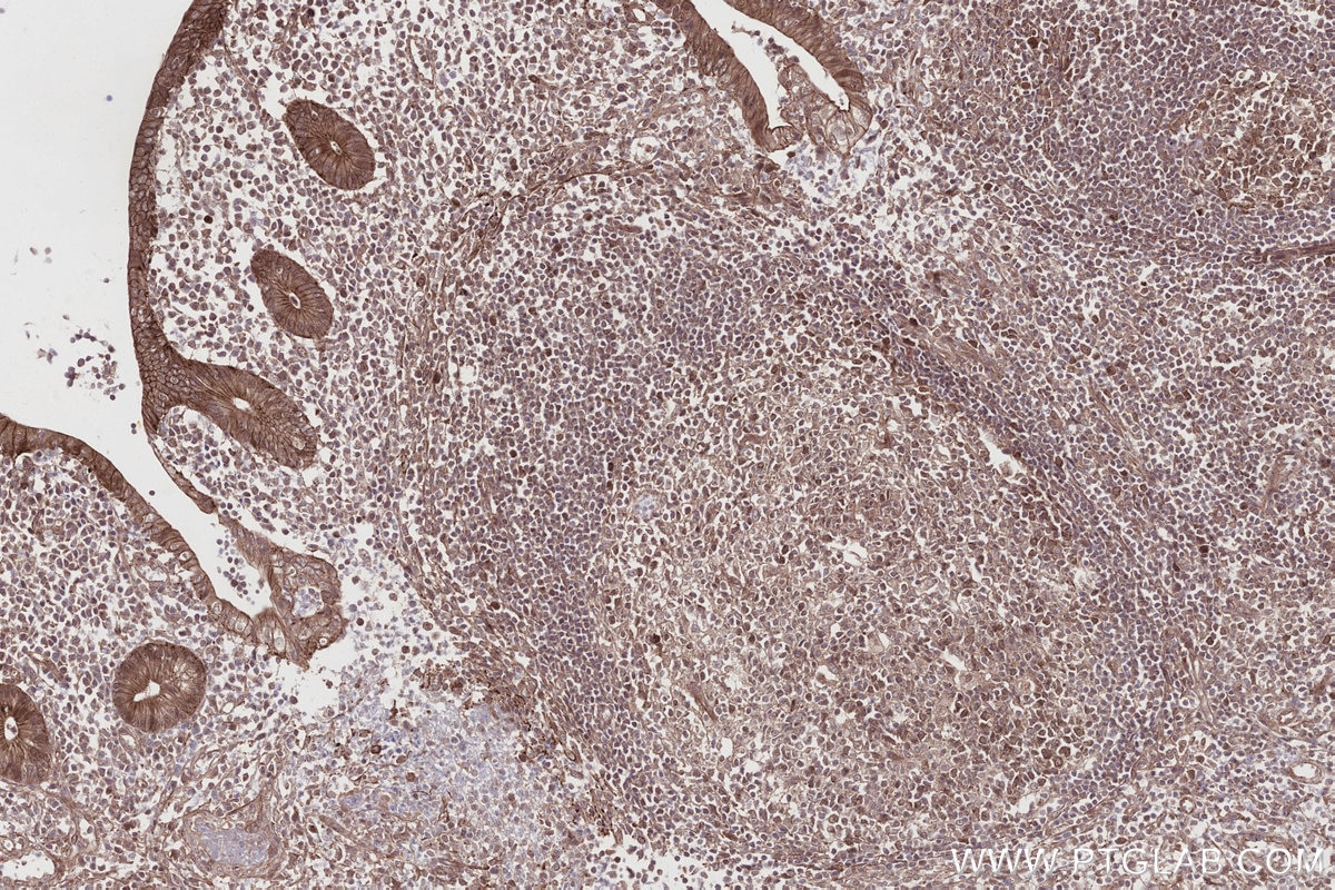 Immunohistochemical analysis of paraffin-embedded human appendicitis tissue slide using KHC2749 (EDEM1 IHC Kit).