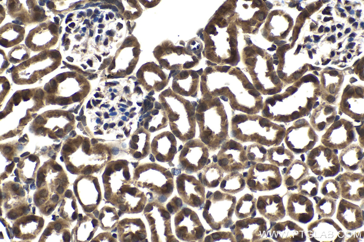 Immunohistochemical analysis of paraffin-embedded mouse kidney tissue slide using KHC1469 (EDF1 IHC Kit).