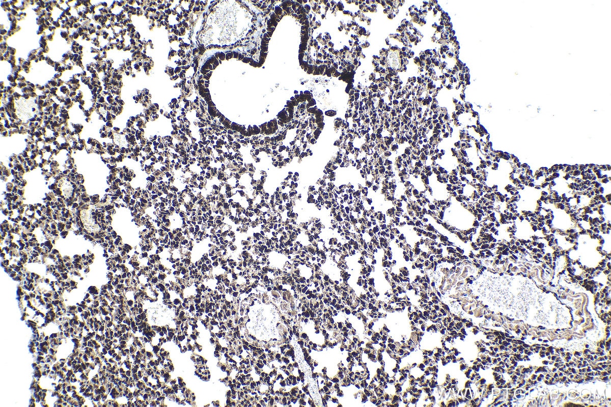 Immunohistochemical analysis of paraffin-embedded mouse lung tissue slide using KHC1469 (EDF1 IHC Kit).