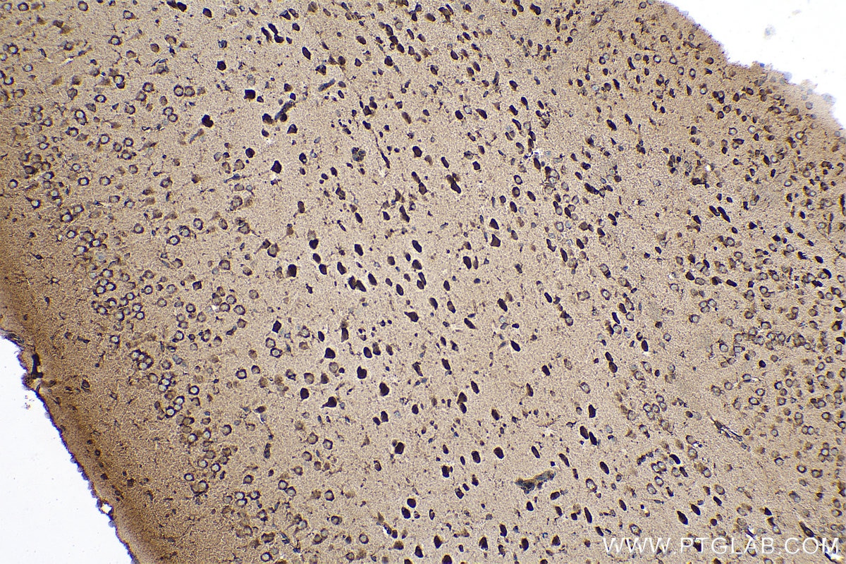Immunohistochemical analysis of paraffin-embedded mouse brain tissue slide using KHC0508 (EEF1A1 IHC Kit).