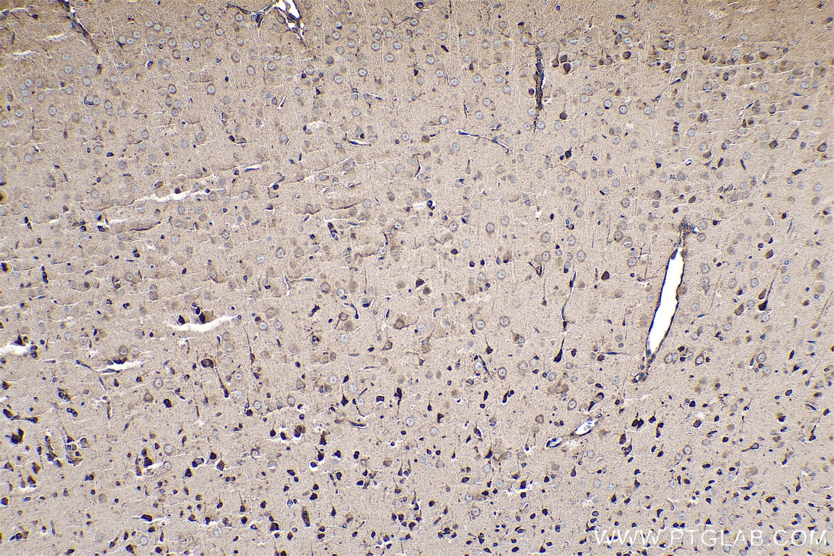 Immunohistochemical analysis of paraffin-embedded rat brain tissue slide using KHC0508 (EEF1A1 IHC Kit).