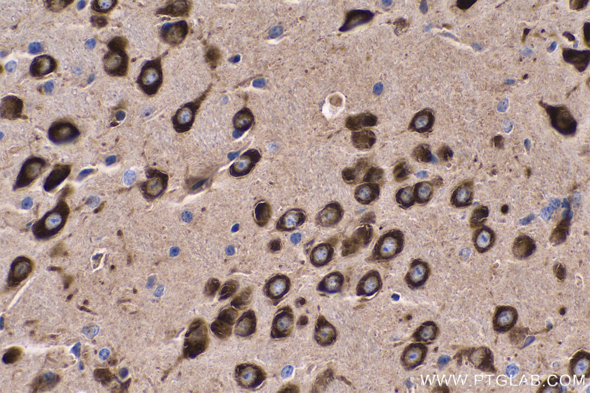 Immunohistochemical analysis of paraffin-embedded mouse brain tissue slide using KHC0563 (EEF1A2 IHC Kit).