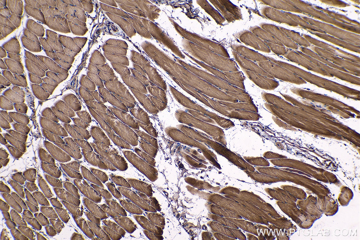 Immunohistochemical analysis of paraffin-embedded mouse skeletal muscle tissue slide using KHC0563 (EEF1A2 IHC Kit).