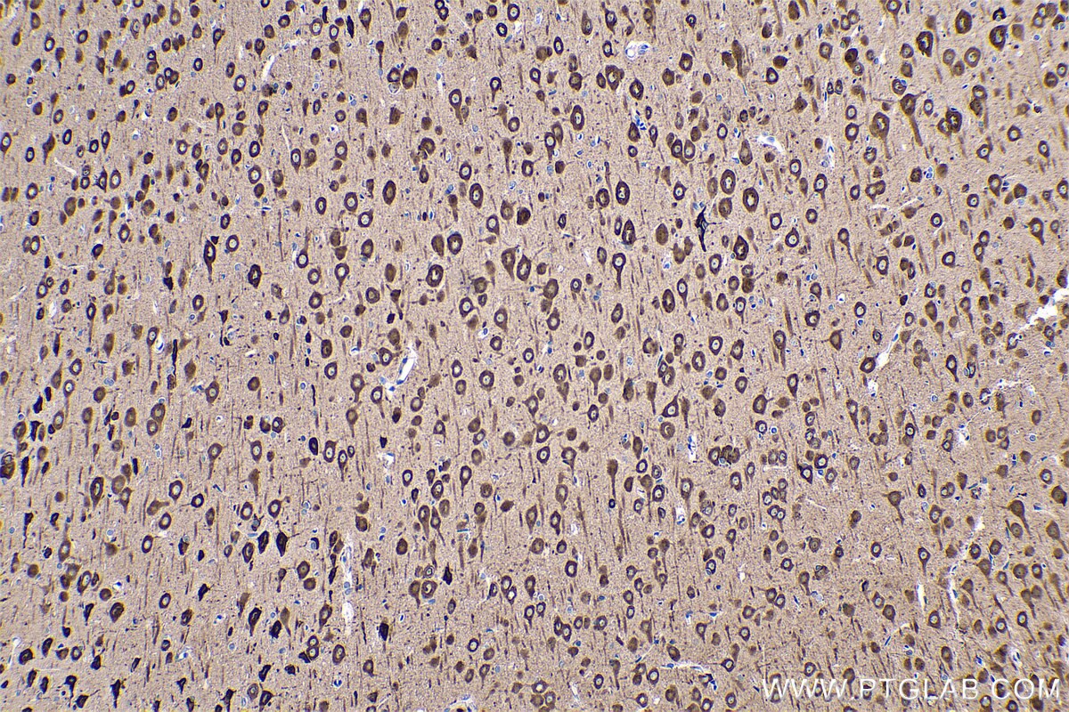 Immunohistochemical analysis of paraffin-embedded rat brain tissue slide using KHC0563 (EEF1A2 IHC Kit).