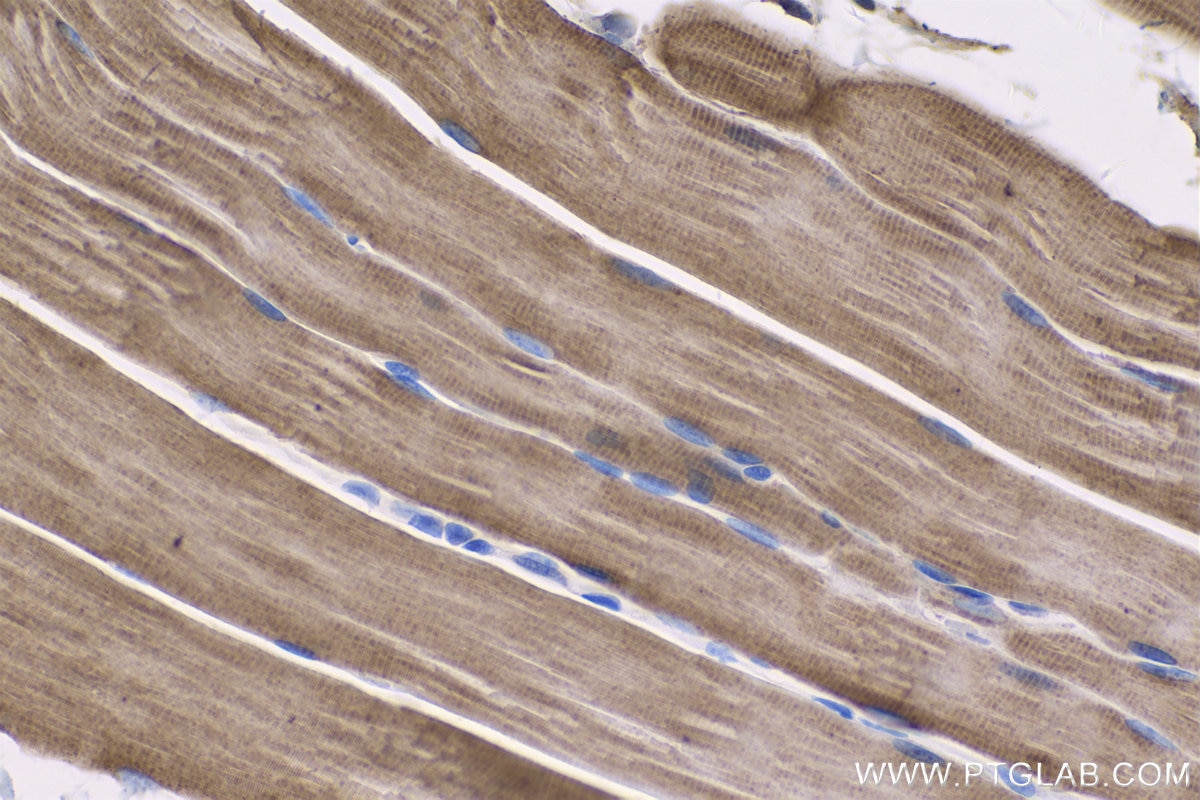 Immunohistochemical analysis of paraffin-embedded rat skeletal muscle tissue slide using KHC0563 (EEF1A2 IHC Kit).