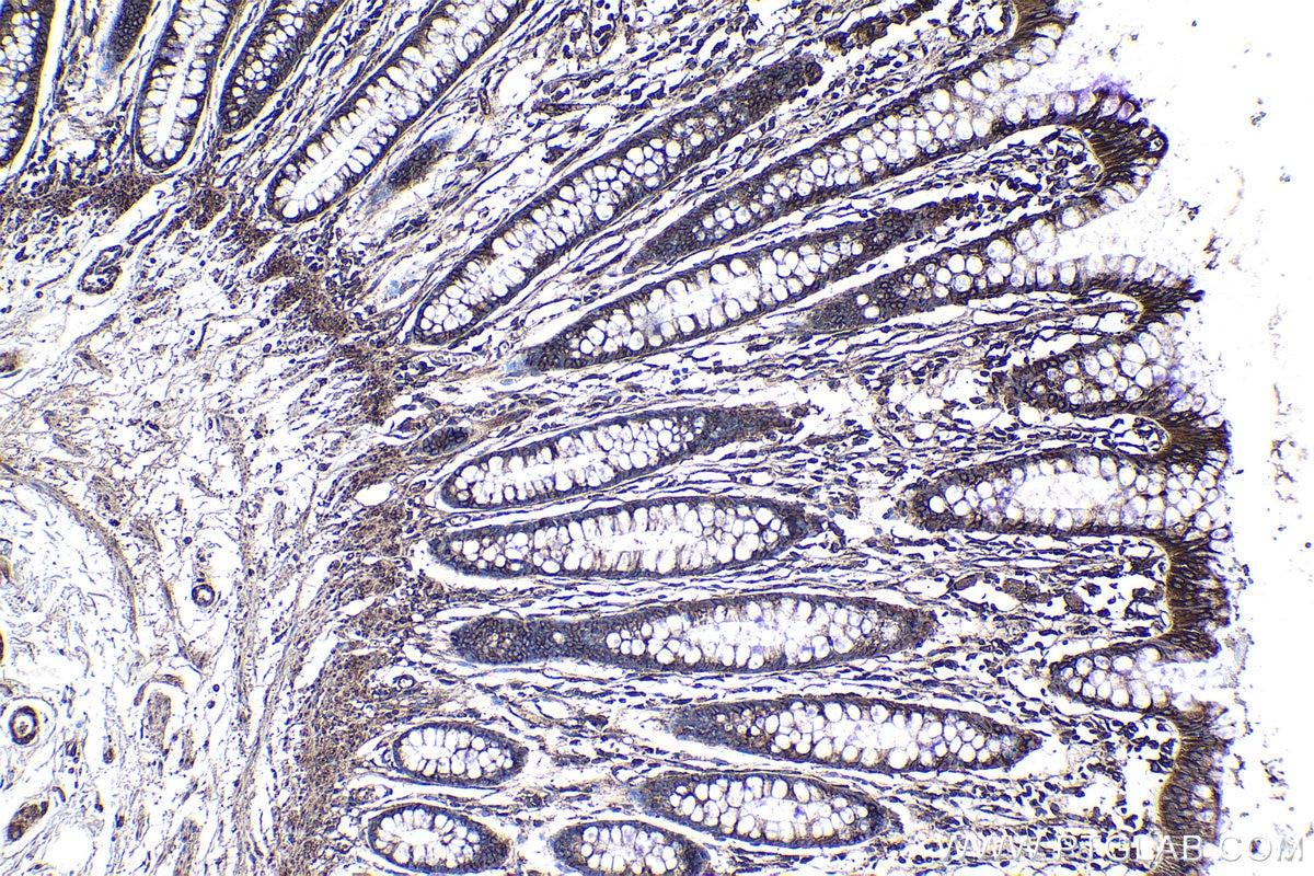 Immunohistochemical analysis of paraffin-embedded human colon tissue slide using KHC1171 (EEF1B2 IHC Kit).