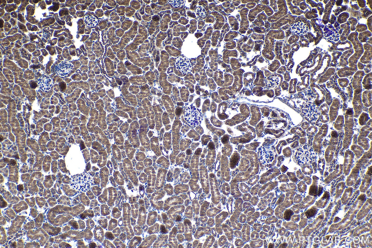 Immunohistochemical analysis of paraffin-embedded mouse kidney tissue slide using KHC1171 (EEF1B2 IHC Kit).
