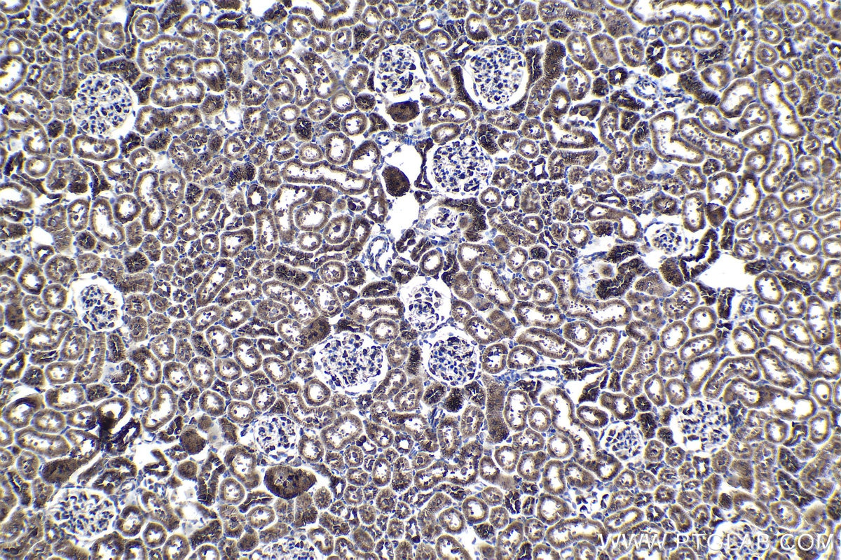 Immunohistochemical analysis of paraffin-embedded rat kidney tissue slide using KHC1171 (EEF1B2 IHC Kit).