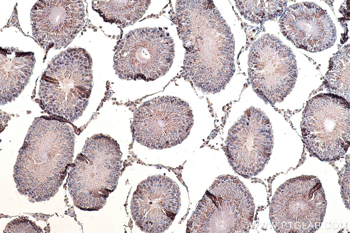 Immunohistochemical analysis of paraffin-embedded rat testis tissue slide using KHC0852 (EEF1D IHC Kit).