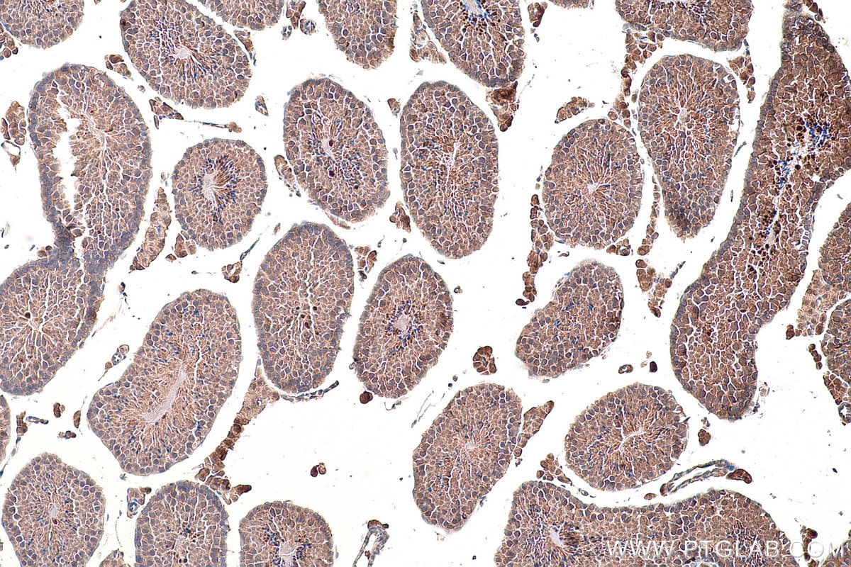 Immunohistochemical analysis of paraffin-embedded mouse testis tissue slide using KHC0852 (EEF1D IHC Kit).