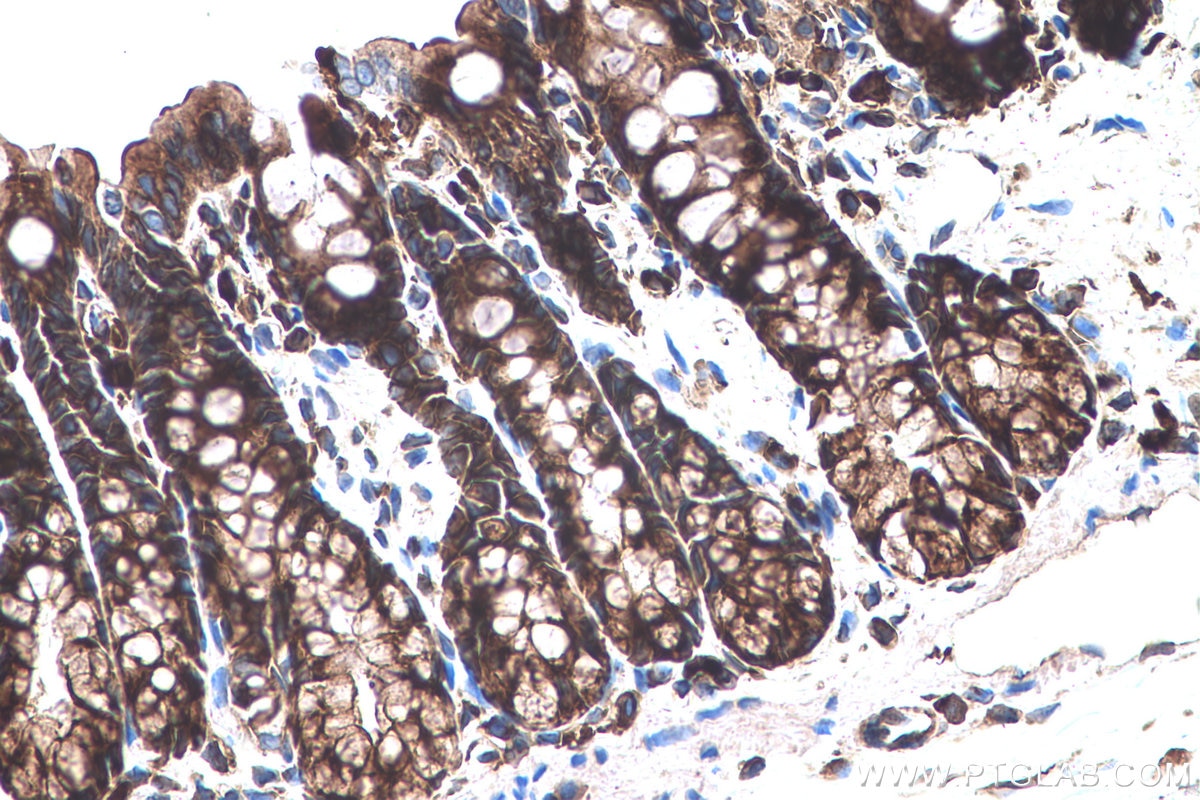 Immunohistochemical analysis of paraffin-embedded rat colon tissue slide using KHC0585 (EEF2 IHC Kit).