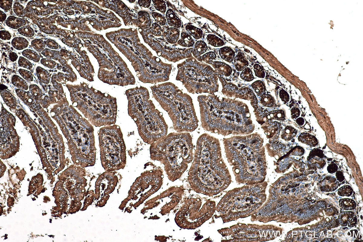 Immunohistochemical analysis of paraffin-embedded mouse small intestine tissue slide using KHC0585 (EEF2 IHC Kit).