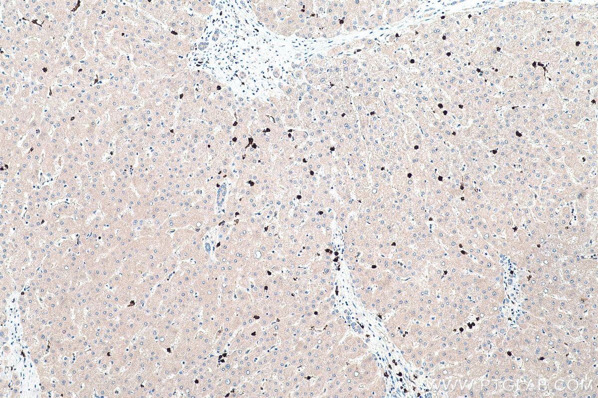 Immunohistochemical analysis of paraffin-embedded human liver tissue slide using KHC0415 (EFHD2 IHC Kit).