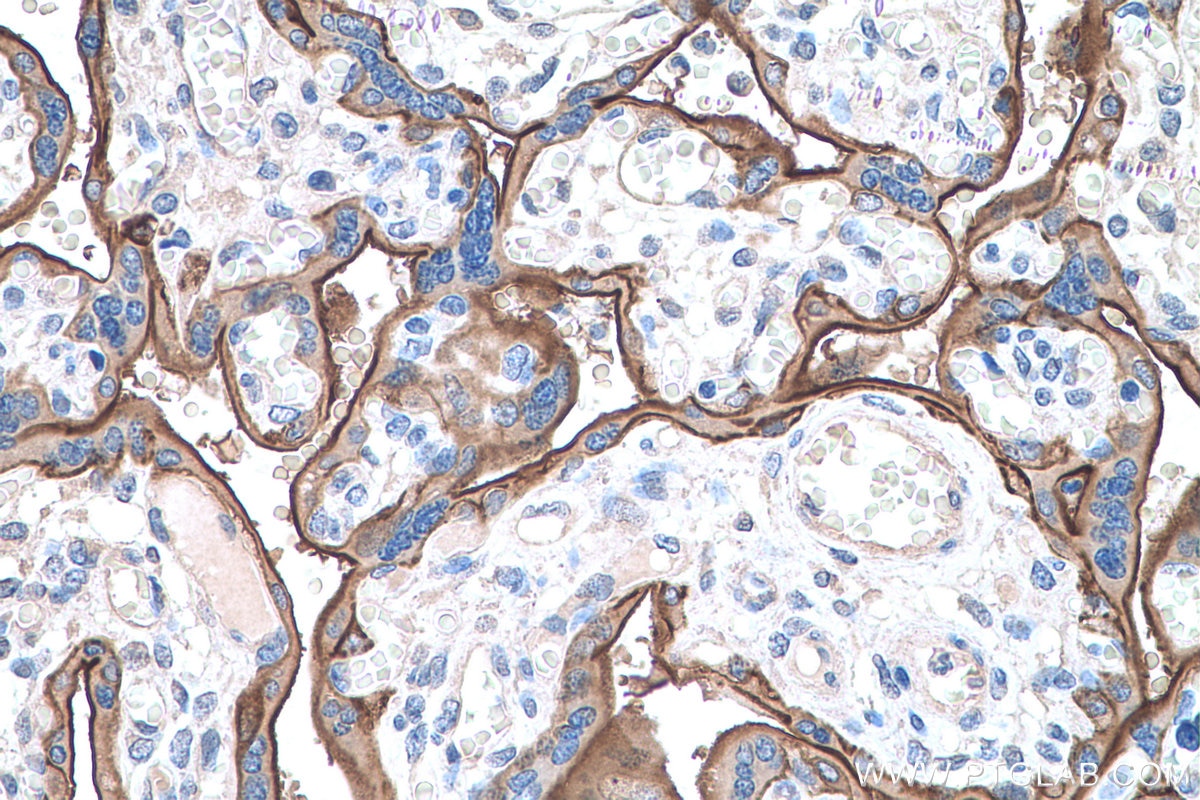 Immunohistochemical analysis of paraffin-embedded human placenta tissue slide using KHC0612 (EGFR IHC Kit).