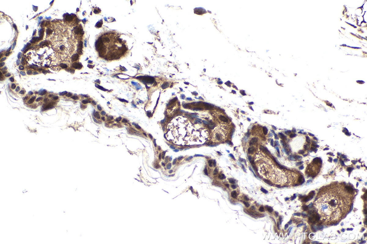 Immunohistochemical analysis of paraffin-embedded mouse skin tissue slide using KHC1935 (EGLN3 IHC Kit).