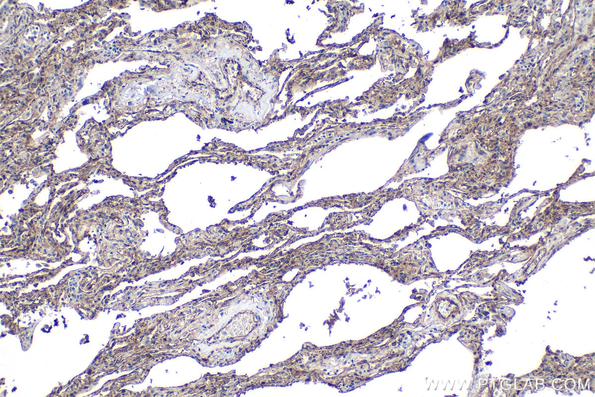 Immunohistochemical analysis of paraffin-embedded human lung tissue slide using KHC1291 (EHD2 IHC Kit).