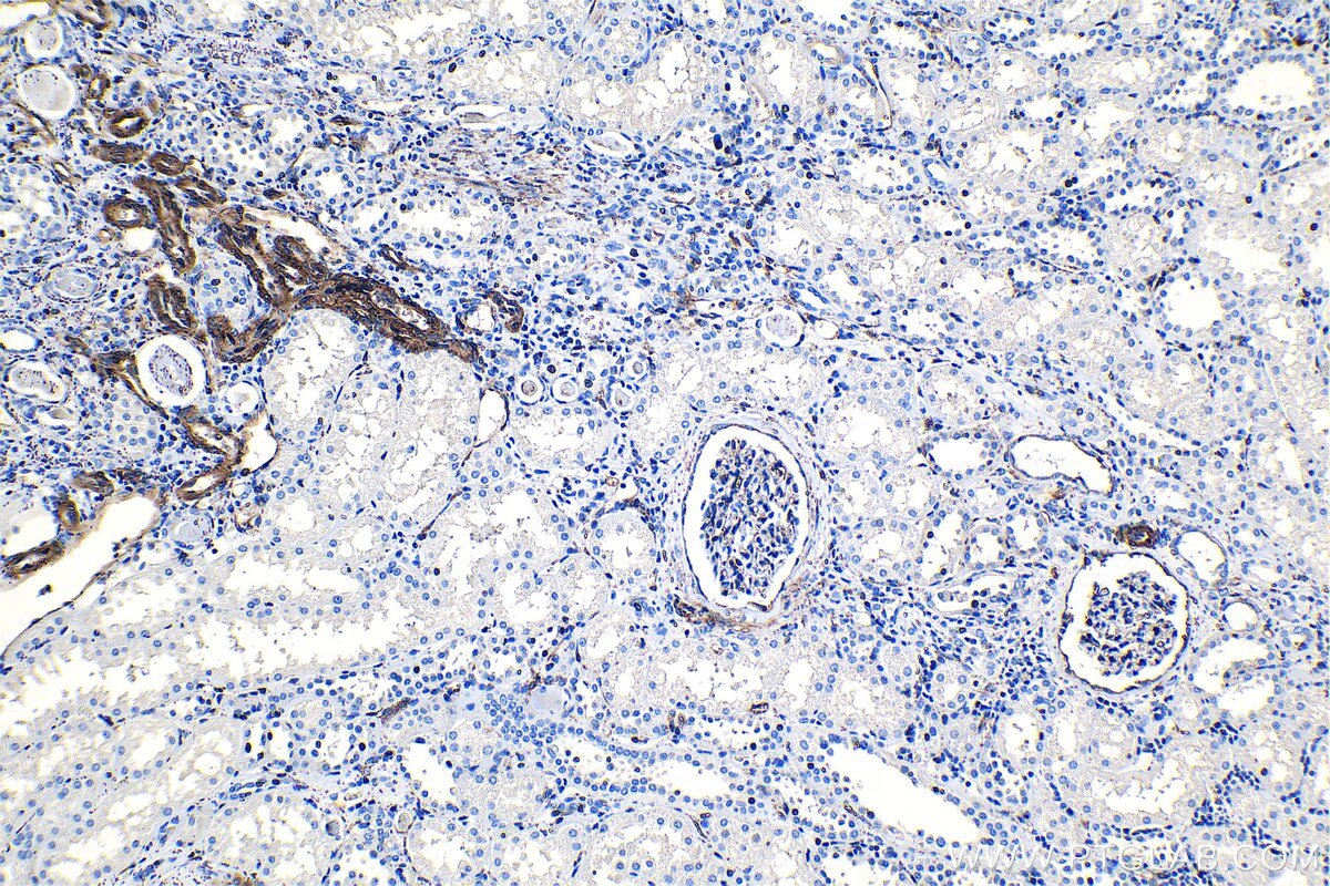 Immunohistochemical analysis of paraffin-embedded human kidney tissue slide using KHC1291 (EHD2 IHC Kit).