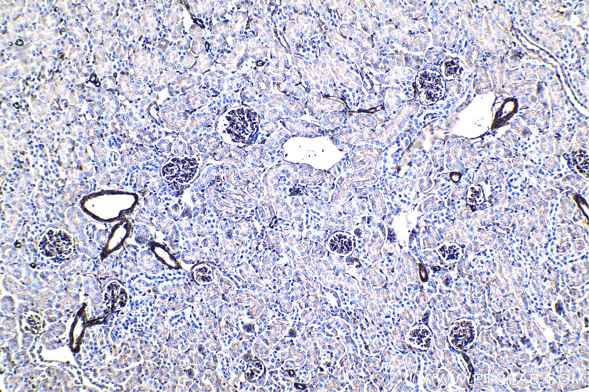 Immunohistochemical analysis of paraffin-embedded mouse kidney tissue slide using KHC1291 (EHD2 IHC Kit).