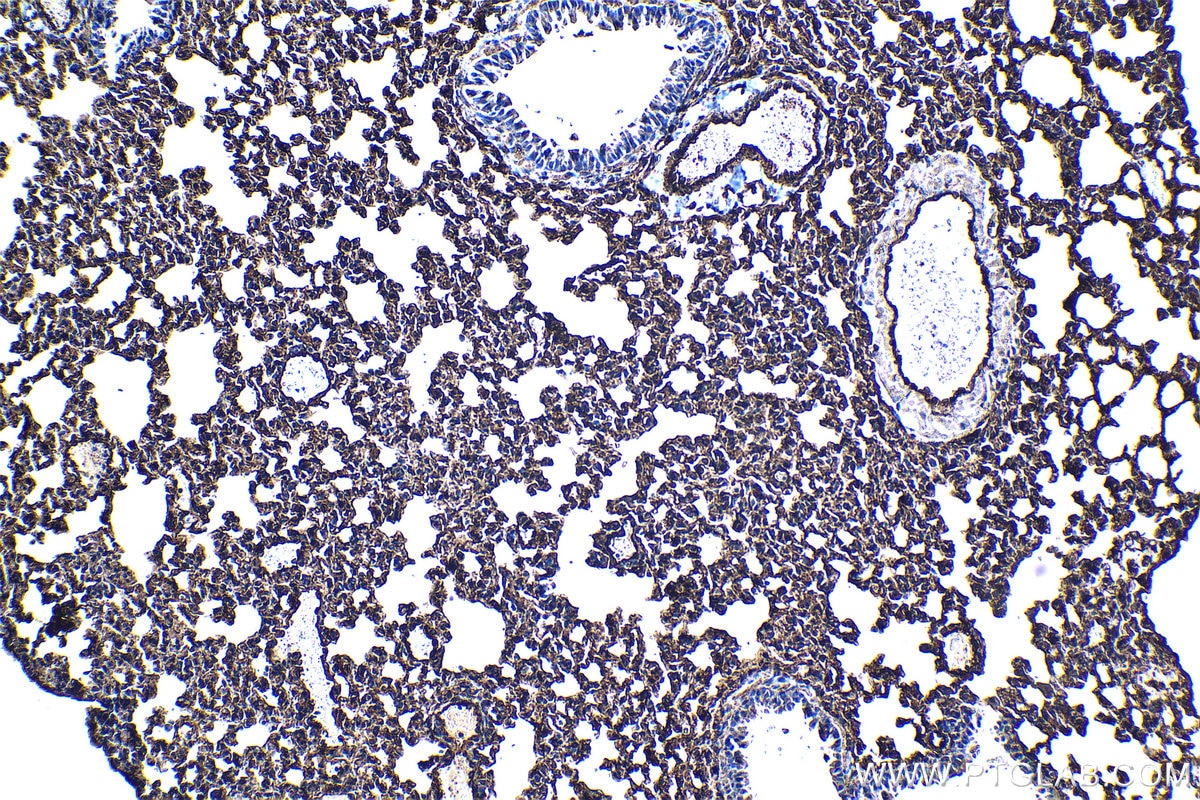 Immunohistochemical analysis of paraffin-embedded mouse lung tissue slide using KHC1291 (EHD2 IHC Kit).