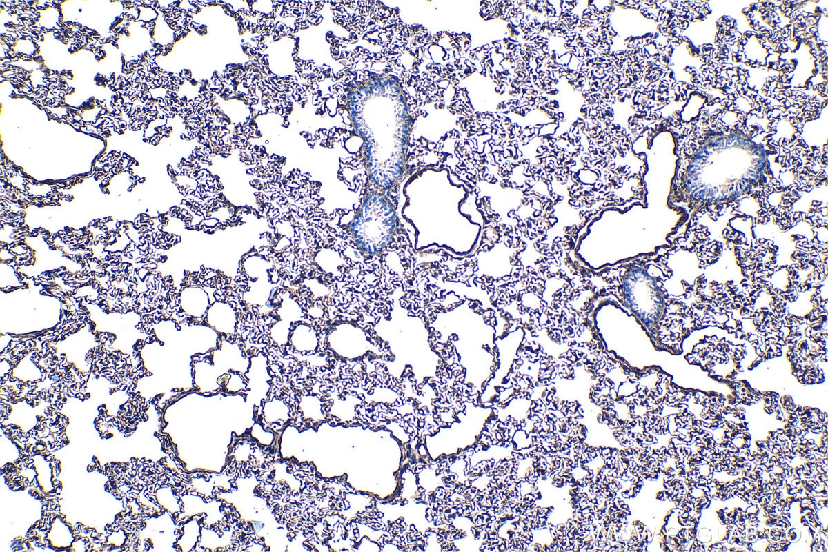 Immunohistochemical analysis of paraffin-embedded rat lung tissue slide using KHC1291 (EHD2 IHC Kit).