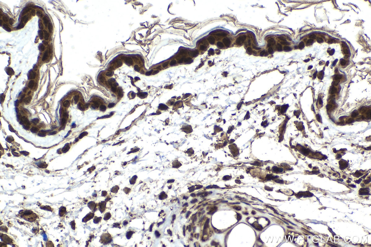 Immunohistochemical analysis of paraffin-embedded mouse skin tissue slide using KHC1546 (EIF2AK2, PKR IHC Kit).