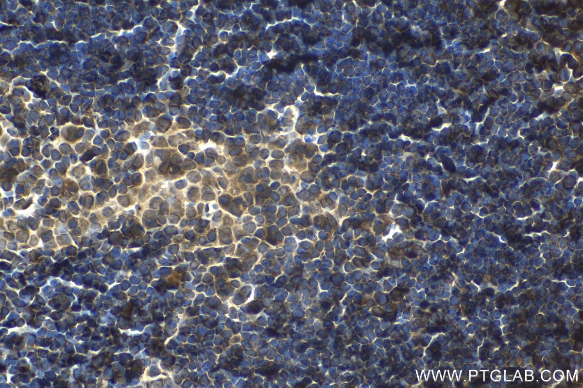 Immunohistochemical analysis of paraffin-embedded mouse thymus tissue slide using KHC1546 (EIF2AK2, PKR IHC Kit).