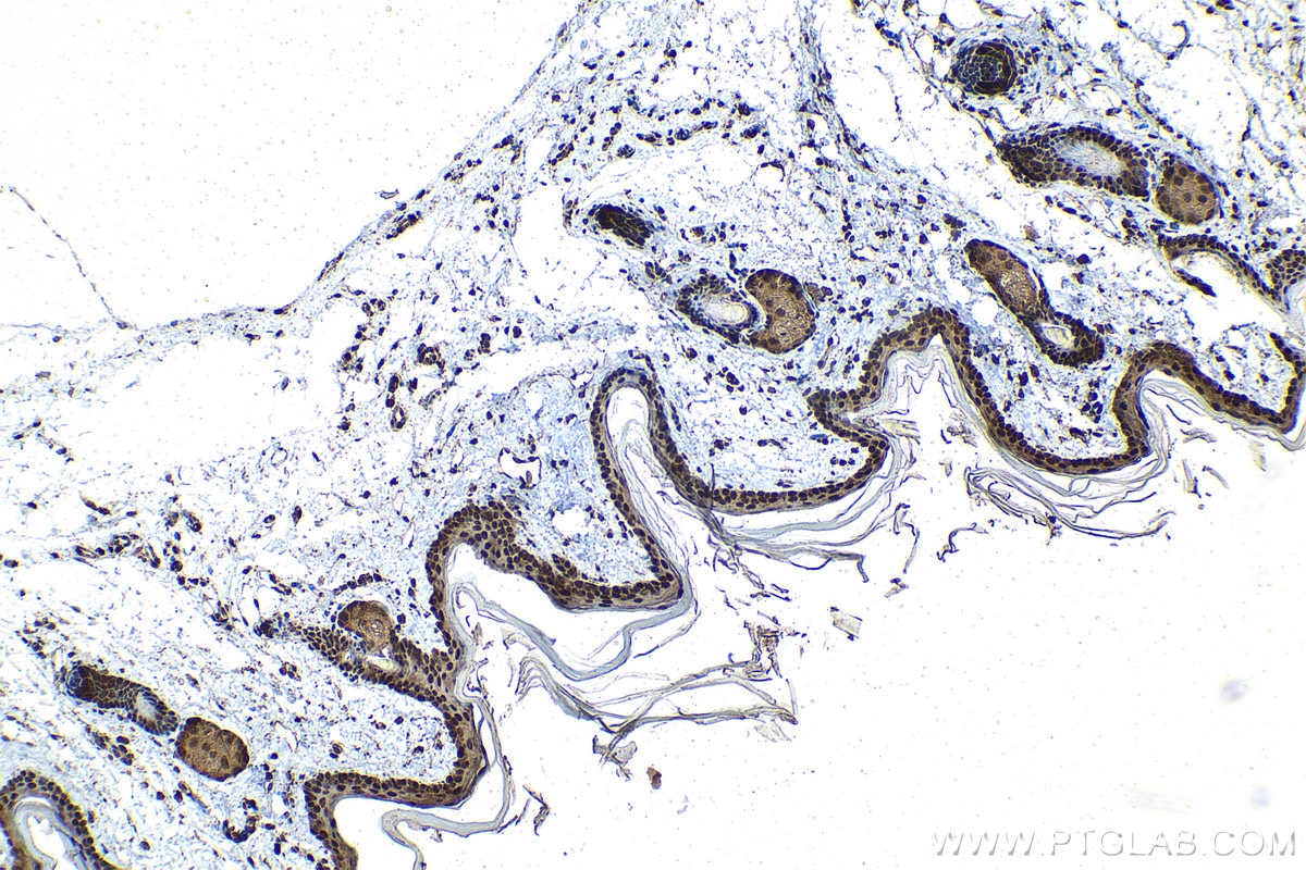 Immunohistochemical analysis of paraffin-embedded rat skin tissue slide using KHC1546 (EIF2AK2, PKR IHC Kit).