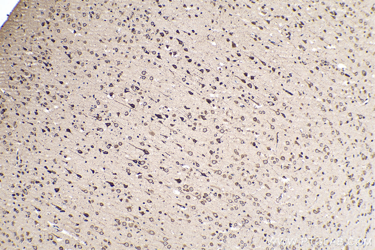 Immunohistochemical analysis of paraffin-embedded rat brain tissue slide using KHC0168 (EIF3C IHC Kit).