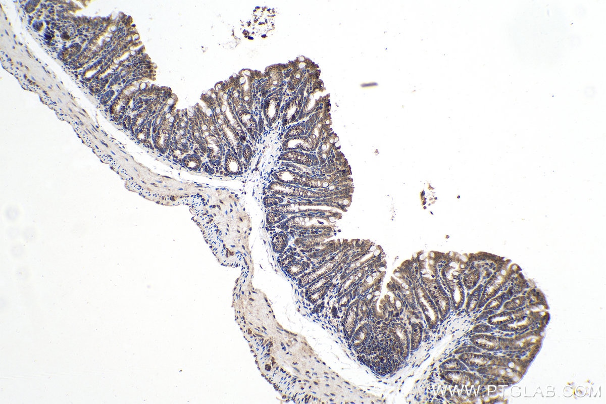 Immunohistochemical analysis of paraffin-embedded mouse colon tissue slide using KHC0168 (EIF3C IHC Kit).