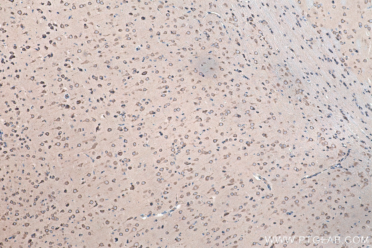 Immunohistochemical analysis of paraffin-embedded rat brain tissue slide using KHC0169 (EIF3D IHC Kit).