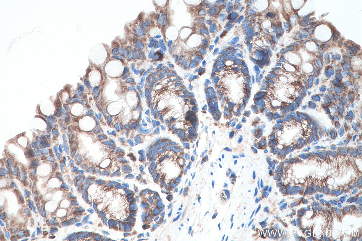 Immunohistochemical analysis of paraffin-embedded mouse colon tissue slide using KHC0170 (EIF3G IHC Kit).