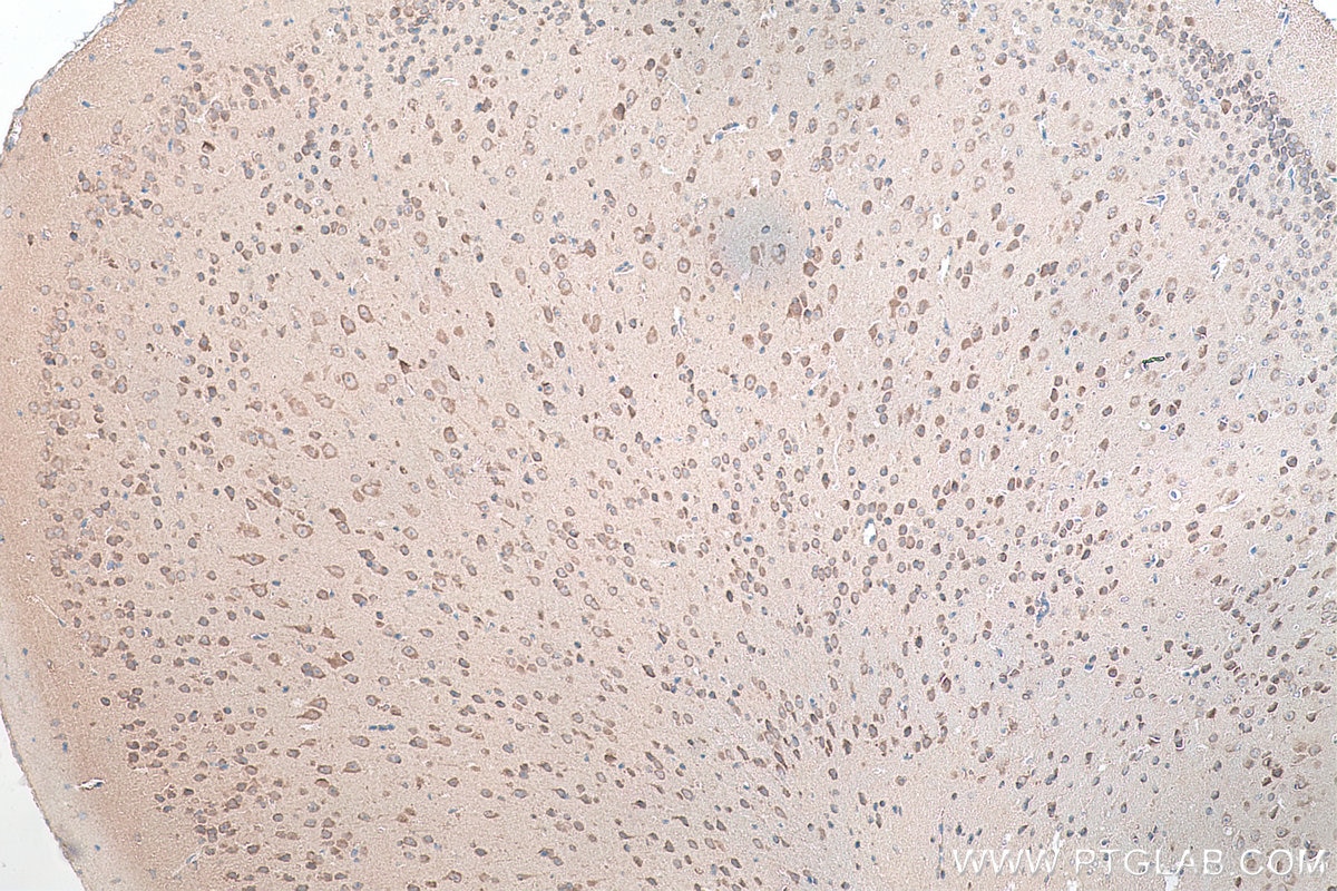 Immunohistochemical analysis of paraffin-embedded mouse brain tissue slide using KHC0171 (EIF3I IHC Kit).