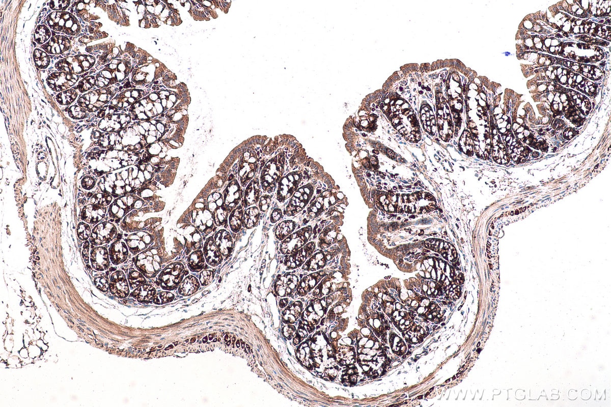 Immunohistochemical analysis of paraffin-embedded mouse colon tissue slide using KHC0925 (EIF3M IHC Kit).