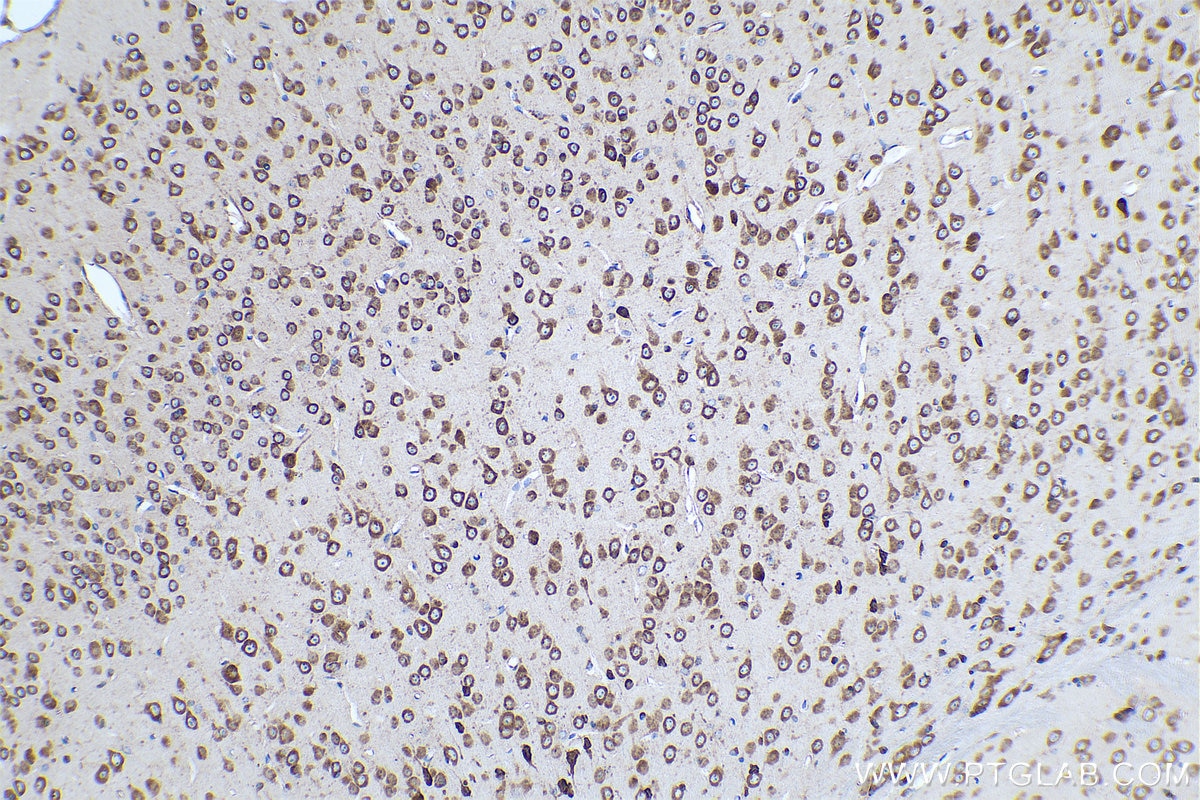 Immunohistochemical analysis of paraffin-embedded mouse brain tissue slide using KHC0925 (EIF3M IHC Kit).